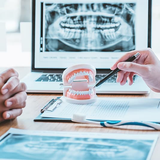 Dentist explaining dental model with X-ray on laptop screen in background. Clipboard and toothbrush on the table.